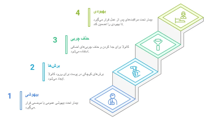 روش انجام