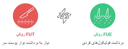 روش ها