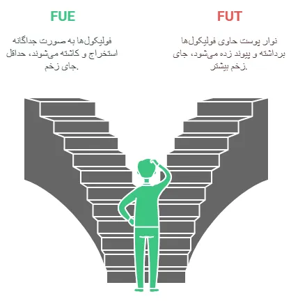 روش ها