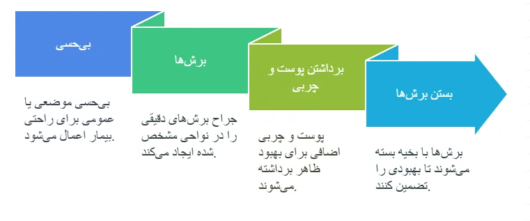 روش ها