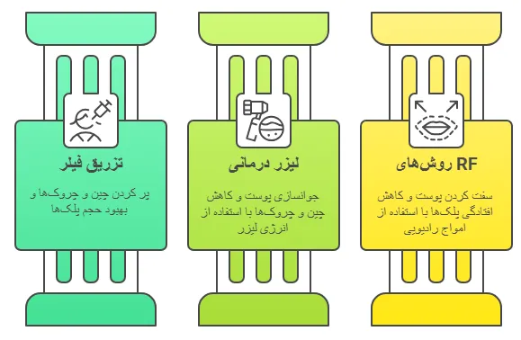 روش ها