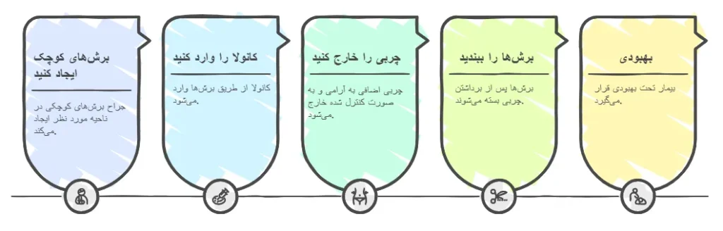 روش ها