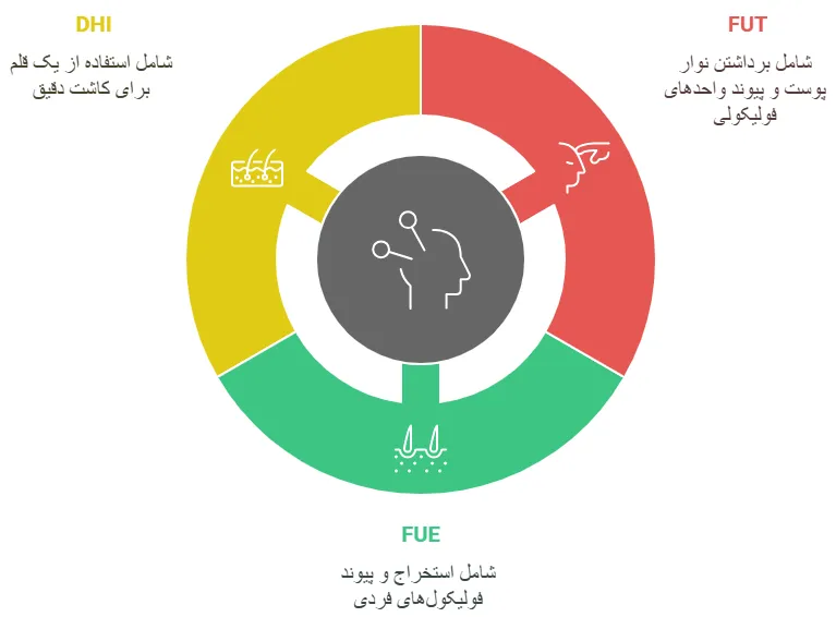 روش ها