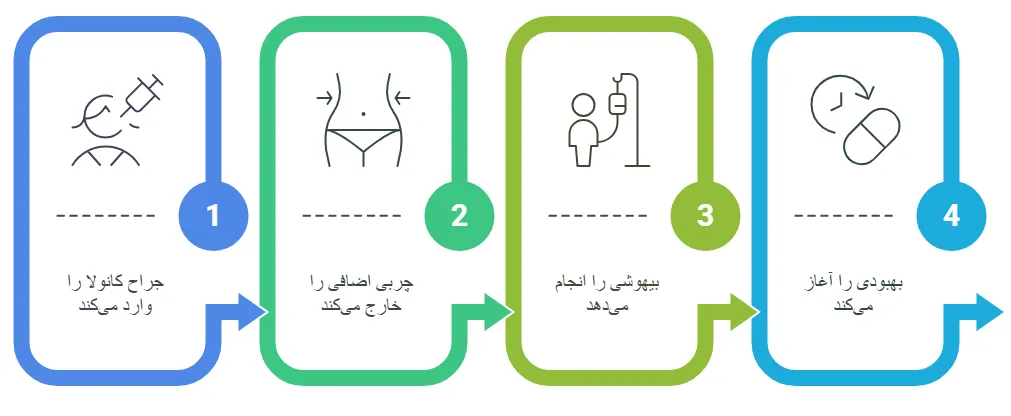روش کار