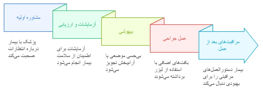 مراحل
