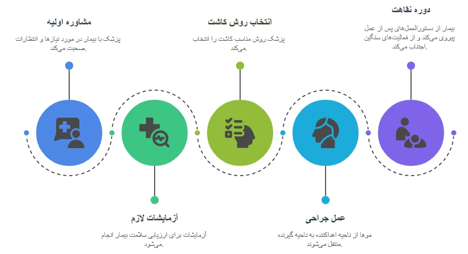 مراحل