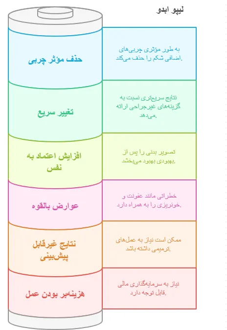مزایا و معایب