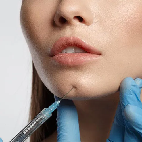 تزریق ژل چانه