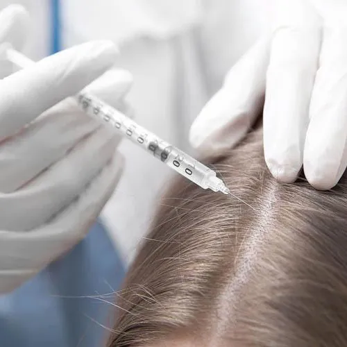 کربوکسی تراپی مو