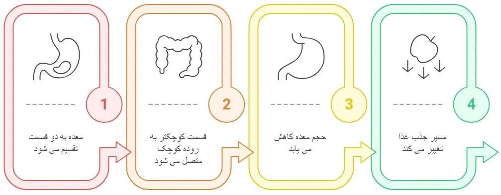 بای پس معده