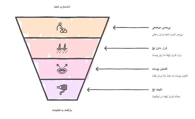 روش ها