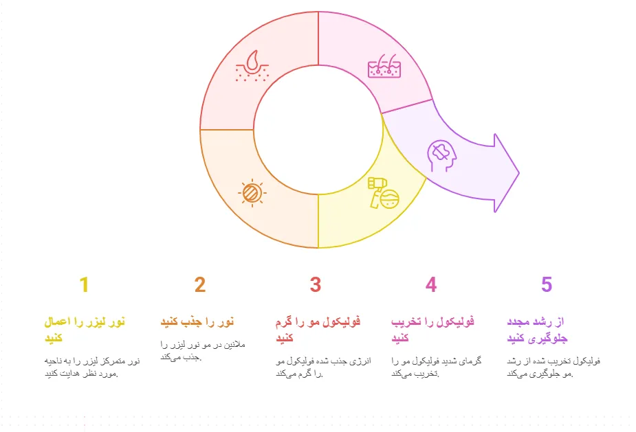 روش کار لیزر