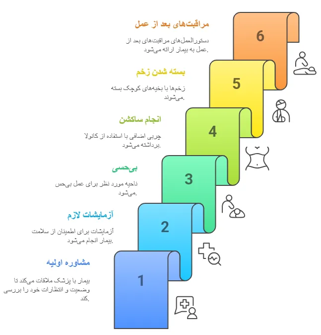 مراحل