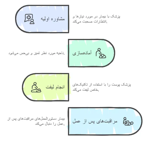 مراحل
