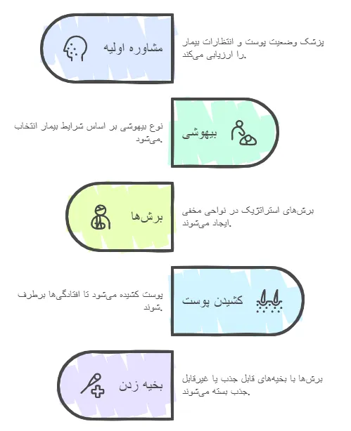 مراحل