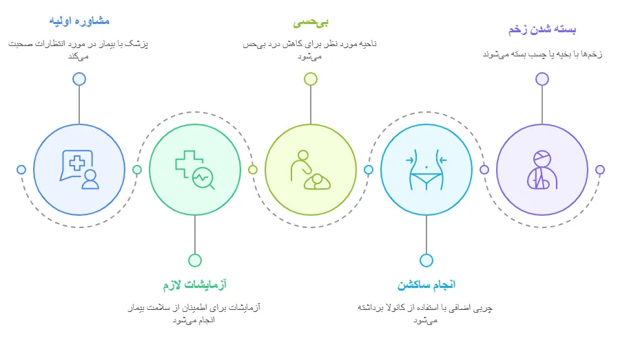 مراحل
