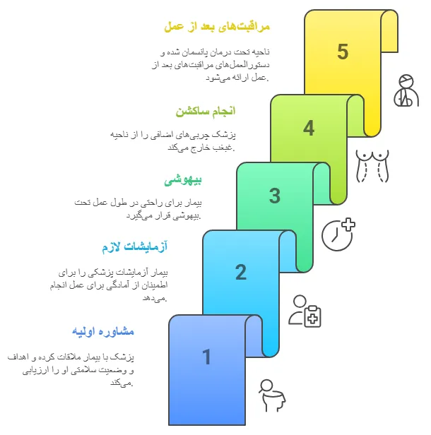 مراحل