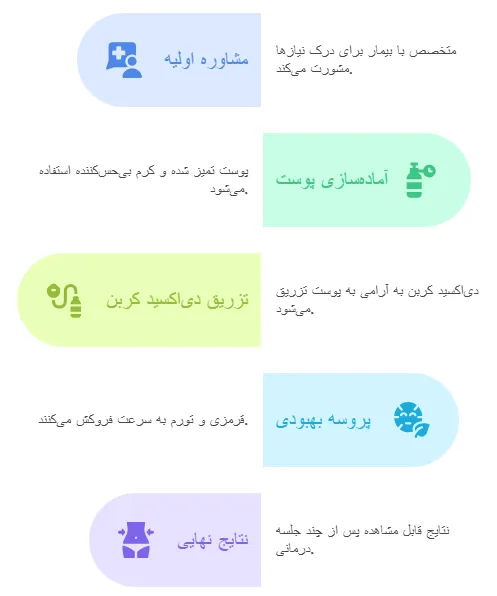 نحوه