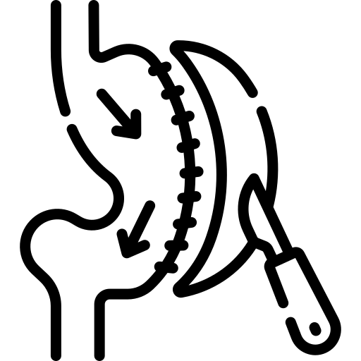 اسلیو معده