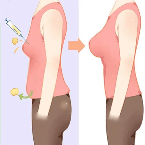 تزریق چربییی