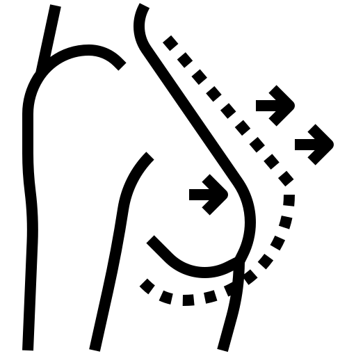 ماموپلاستی