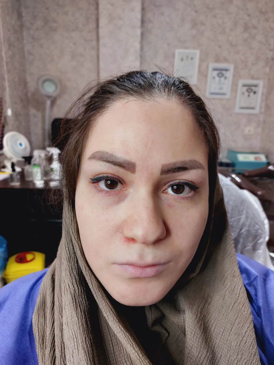 کاشت ابروووو